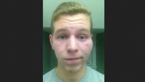 anti gay hate crime victim