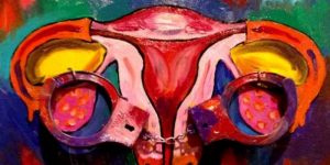 Intimidation Act Becomes Art Fundraiser For Reproductive Rights